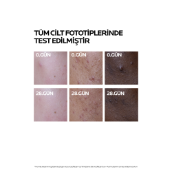 Effaclar Duo+M Yağlı, Akne/Sivilce Eğilimli Ciltler için Bakım Kremi 40ml